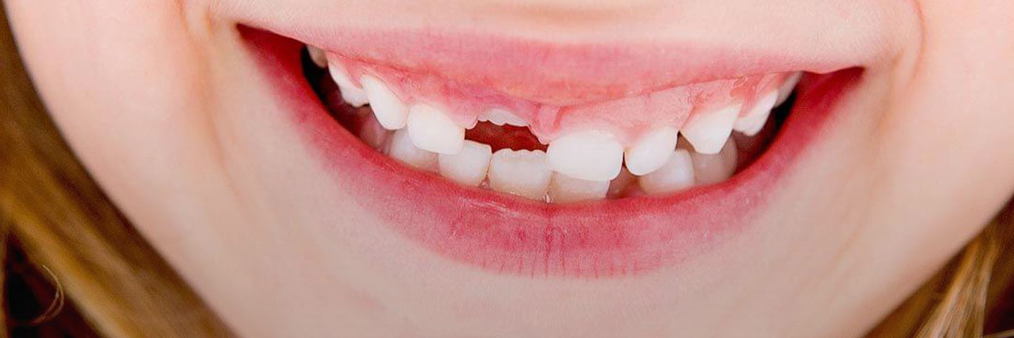 Детские зубные феномены