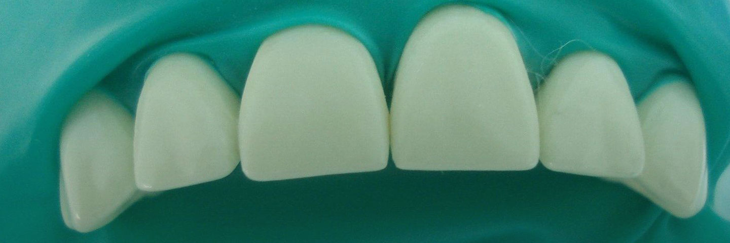 От ракушек до титана: краткая история стоматологии