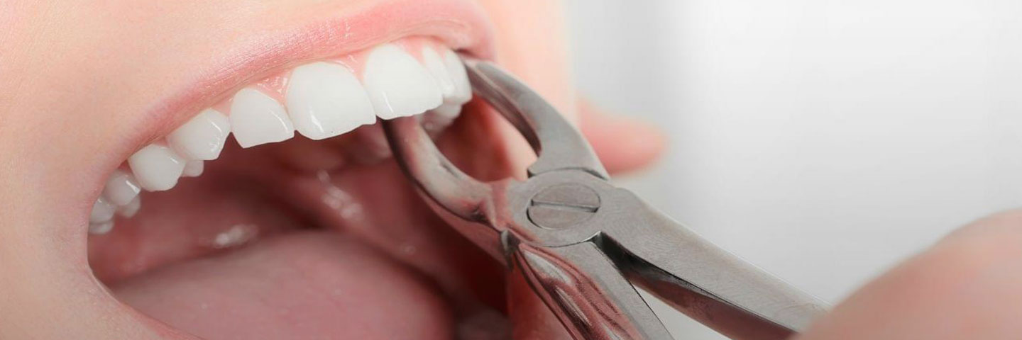 Что делать после удаления молочного зуба: общие рекомендации